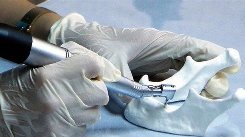 “Alman malı” denilen implant Kore menşeli çıkınca savcılığa başvurdu